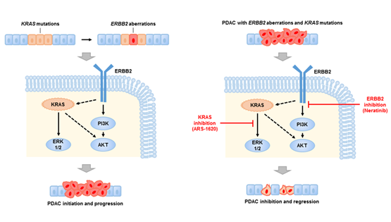 王躍祥研究組發(fā)現(xiàn)胰腺癌的新型治療靶點(diǎn)