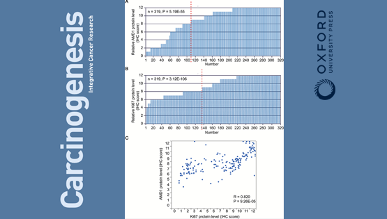 陳雁研究組合作發(fā)現(xiàn)多胺代謝在胃癌發(fā)生和預(yù)后中的作用