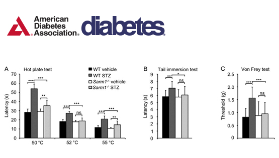 翟琦巍研究組發(fā)現(xiàn)防治糖尿病外周神經(jīng)病變的新靶點