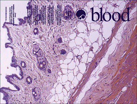 中國(guó)科學(xué)院上海營(yíng)養(yǎng)與健康研究院科研人員揭示Hsp90調(diào)控Ezh2蛋白穩(wěn)定性參與移植物抗宿主病的重要機(jī)制