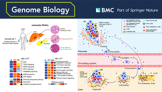 李虹、李亦學(xué)研究組合作破譯胰腺癌肝轉(zhuǎn)移的分子特征