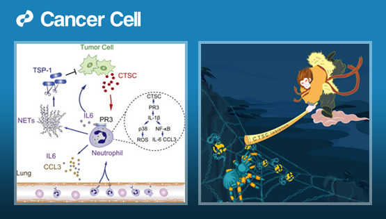 胡國宏研究組發(fā)現(xiàn)乳腺癌肺轉(zhuǎn)移調(diào)控的新機制
