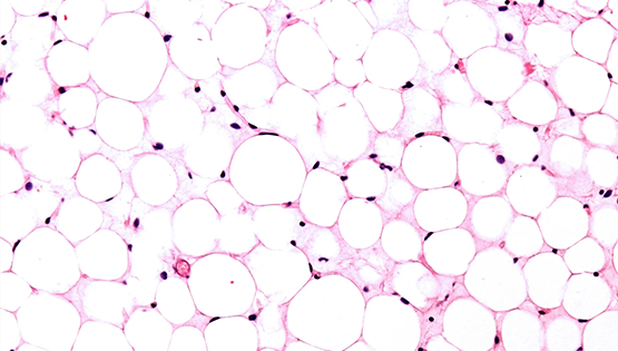 營養(yǎng)與健康所翟琦巍研究組研究成果獲Nature研究亮點專評