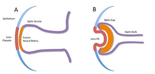 一個(gè)“小杯子”的發(fā)育承載了光明的駛來