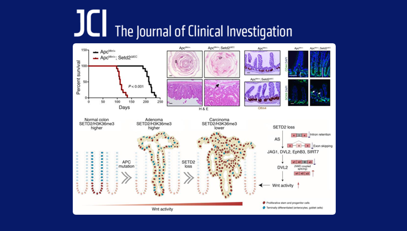 中國科學(xué)院上海營養(yǎng)與健康研究院科研人員揭示組蛋白H3K36三甲基轉(zhuǎn)移酶SETD2在腸癌中的重要功能及調(diào)控機制