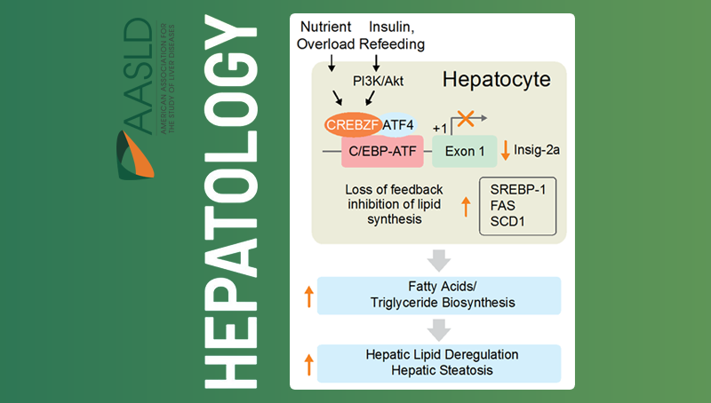 李于研究組發(fā)現(xiàn)治療非酒精性脂肪肝合并胰島素抵抗的新靶點(diǎn)