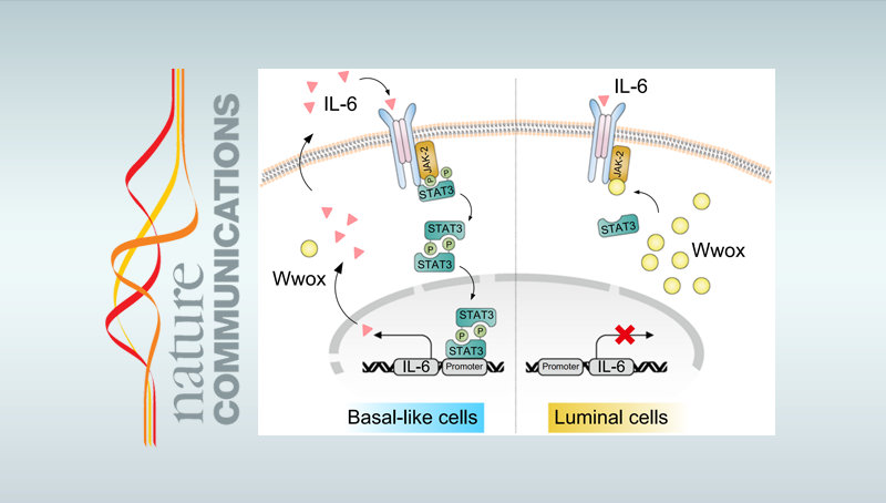 詹麗杏研究組發(fā)現(xiàn)三陰性乳腺癌治療新靶標(biāo)