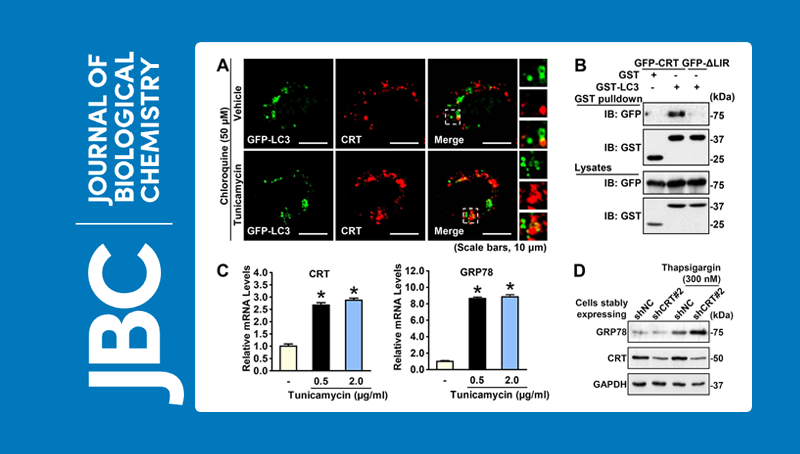 李于研究組發(fā)現(xiàn)關(guān)鍵內(nèi)質(zhì)網(wǎng)伴侶蛋白協(xié)同自噬途徑負反饋調(diào)節(jié)細胞應激反應的新機制