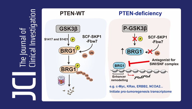 秦駿研究組發(fā)現(xiàn)協(xié)同致死PTEN缺失前列腺腫瘤的表觀遺傳基因