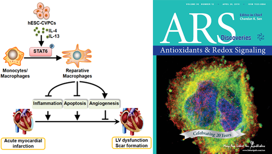 楊黃恬研究組揭示人胚胎干細(xì)胞（hESCs）來(lái)源的心血管前體細(xì)胞（CVPCs）移植對(duì)急性心肌梗死的保護(hù)作用