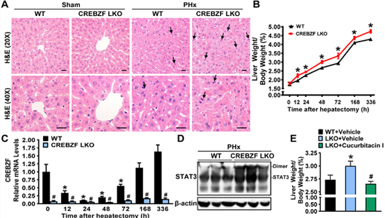 李于研究組發(fā)現(xiàn)CREB/ATF堿性亮氨酸拉鏈轉(zhuǎn)錄因子調(diào)控肝臟組織再生的新機(jī)制