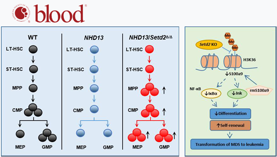 王蘭研究組揭示SETD2調(diào)控骨髓增生異常綜合征轉(zhuǎn)白血病的新機制