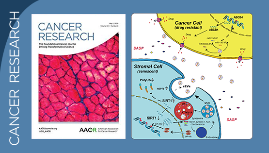孫宇研究組發(fā)現(xiàn)衰老細(xì)胞衍生小胞外囊泡并引發(fā)微環(huán)境中癌細(xì)胞獲得性耐藥的關(guān)鍵機制
