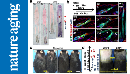 營養(yǎng)與健康所張亮研究組合作發(fā)現(xiàn)皮膚上皮組織衰老的新調(diào)控機(jī)制與潛在治療標(biāo)靶