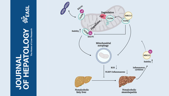 營(yíng)養(yǎng)與健康所丁秋蓉研究組發(fā)現(xiàn)治療非酒精性脂肪肝炎的潛在新靶點(diǎn)