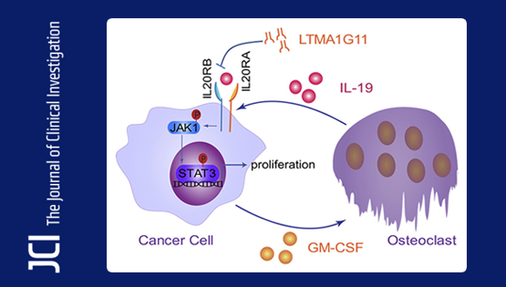 營(yíng)養(yǎng)與健康所胡國(guó)宏研究組發(fā)現(xiàn)肺癌骨轉(zhuǎn)移調(diào)控新機(jī)制