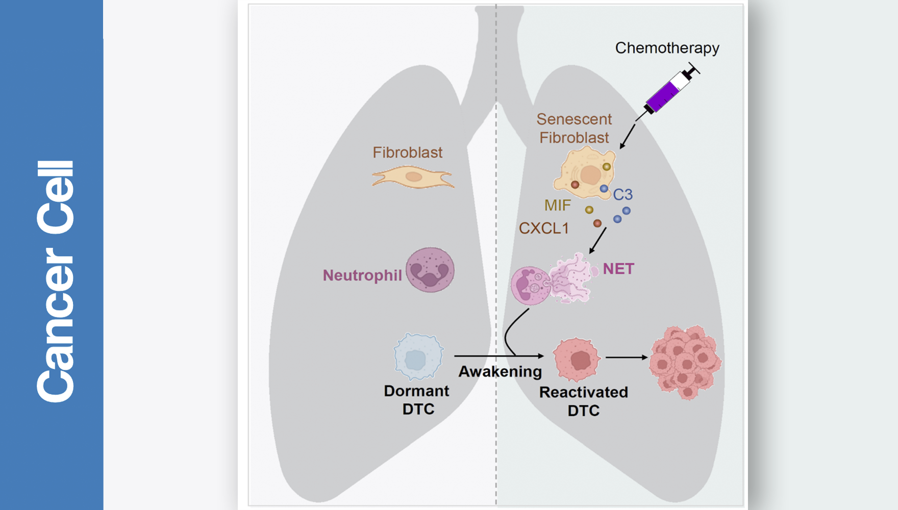 營養(yǎng)與健康所胡國宏研究組揭示化療喚醒休眠乳腺癌細(xì)胞導(dǎo)致轉(zhuǎn)移復(fù)發(fā)