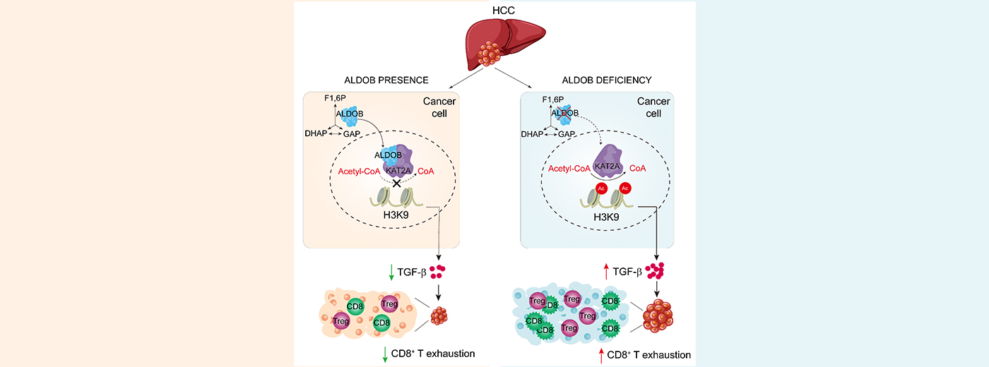 營養(yǎng)與健康所尹慧勇研究組合作發(fā)現(xiàn)肝癌腫瘤細胞代謝影響腫瘤免疫新機制